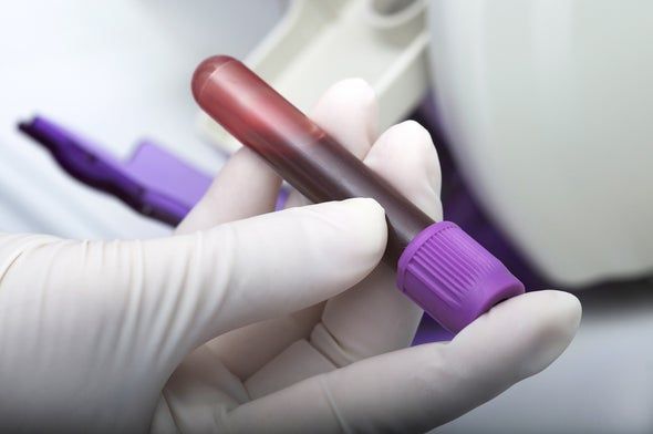 Prohibicion De Examenes de Sangre a Nivel Nacional